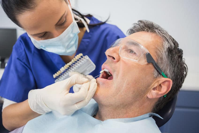 What to Expect When Visiting a Veneer Doctor