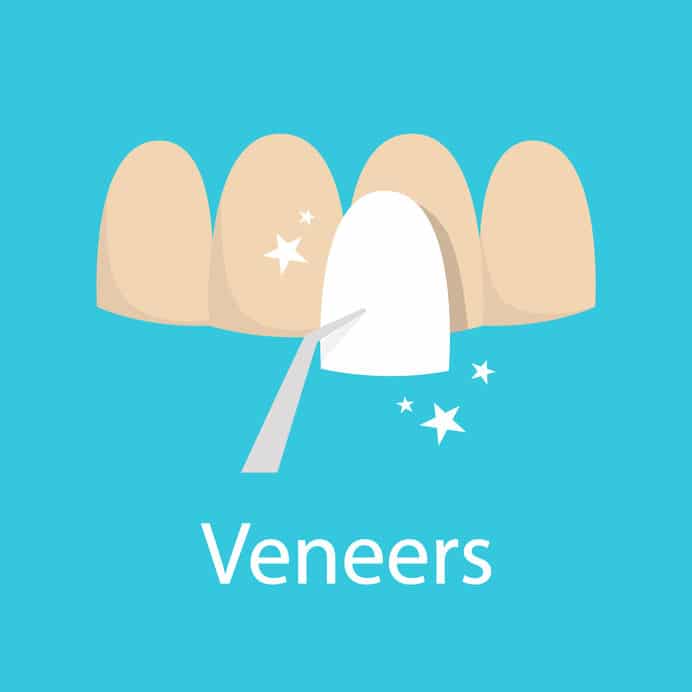 Veneer teeth cover